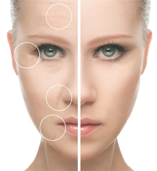 Sinoz 24K gold beauty сыворотка 30 мл коллаген Гиалуроновая кислота против старения Осветляющий, увлажняющий