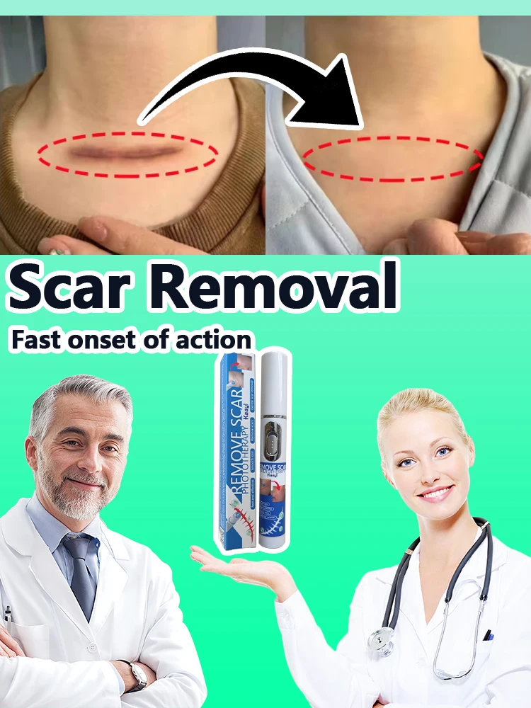 

Fast Remove Burn Keloid | Recovery Scar | Laser therapy Keloid scar