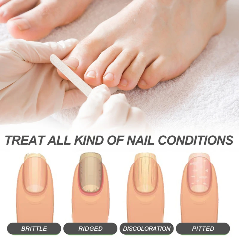 

Discolored Damaged Nail Foot Care Tool Toenail Fungus Patch Waterproof Nail Repair