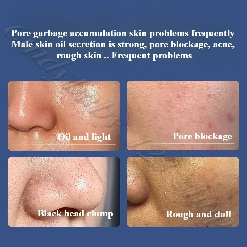 منظف للوجه بالأحماض الأمينية من الكربون المنشط للرجال، زيت تنظيف عميق مضاد لحب الشباب/الرؤوس السوداء/منظف المسام 130 جرام #5