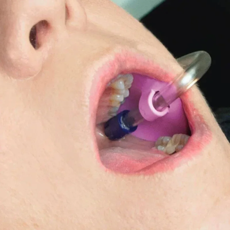 10pcs Autoclavable Dental Suction Tube Holder Oral Care Tools Saliva Ejector HVE Tube Positioner