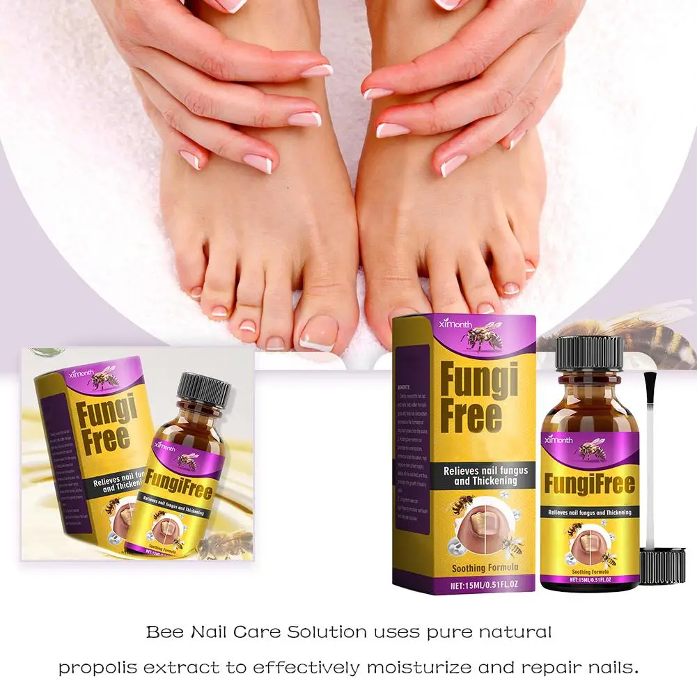 

Nail Fungus Treatment Liquid Bee Gray Nail Thick Toe Essence Soft Nail Liquid Nail Shine Foot Cream Care Essence Repair M9Q9