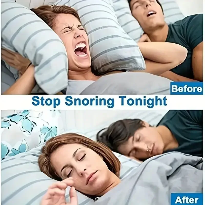 1pc Anti Snoring Nasal Dilator for Easy Breathing Cones Congestion Aid Sleeping Aid Equipment Stop Snoring Nasal Dilators