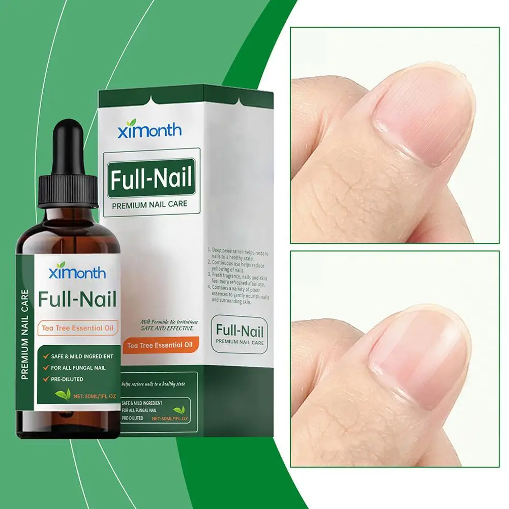 New High-end 30ml Tea Tree Essence Nail Repair Hardener Natural Or Essential Damage Fix Renew Oil & Nail Toenail Fingernail