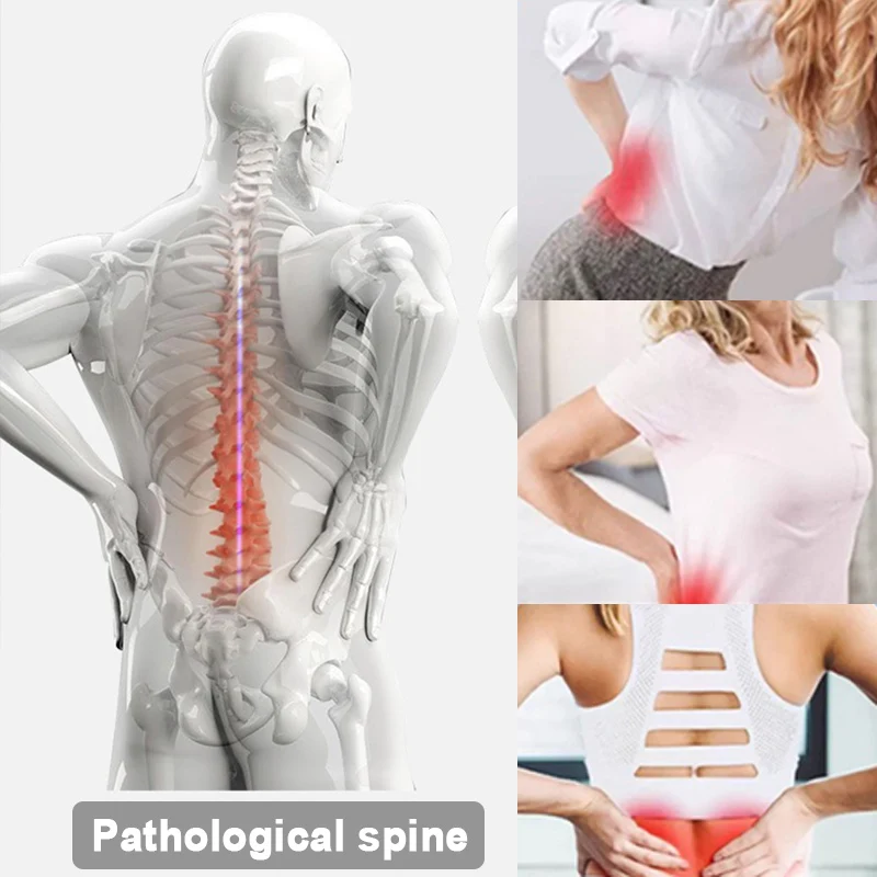 Lower Back Pain, Waist Stretcher Device Back Open Device Back Yoga Spinal Correction Pillow Body Stretcher Hunchback Corrector