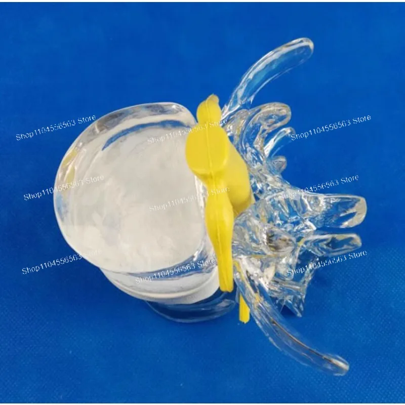 فتق القرص بثق العمود الفقري والعمود الفقري ، نموذج عرض القرص القطني ، نموذج العمود الفقري القطني منتج جديد #2