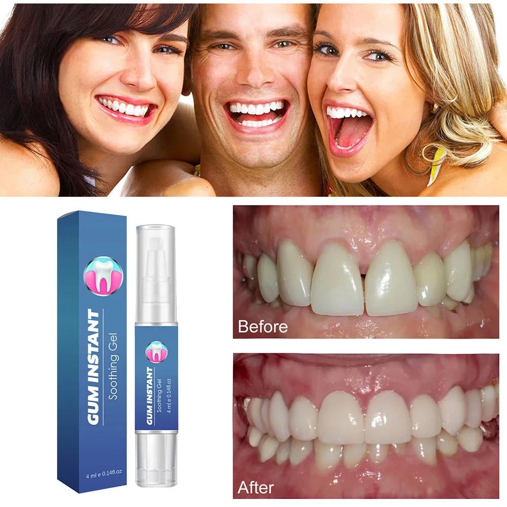 Gums Discomfort Relieve Jel Inflammation Discomfort Reduces Teeth Jels For Tooth