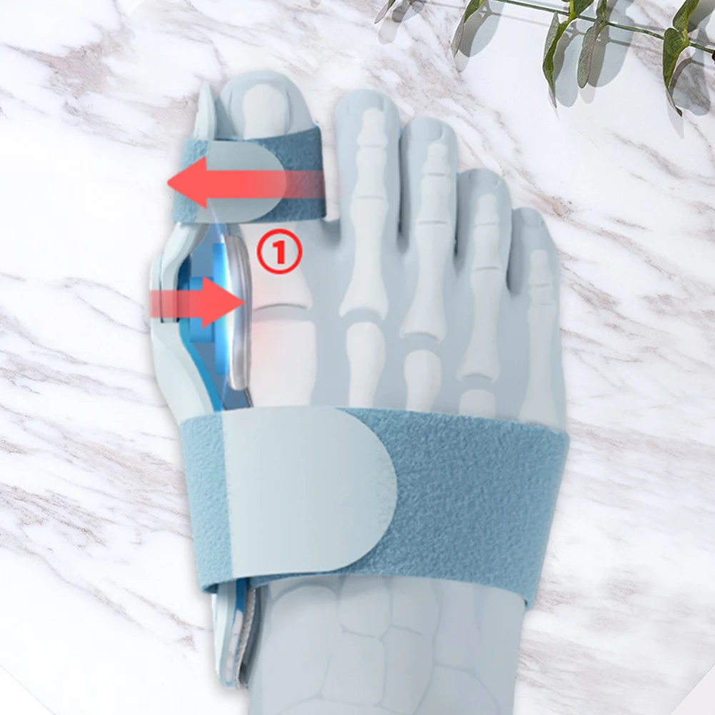 Correcteur d'oignon orthopédique, 1 pièce, attelle d'oignon pour Hallux Valgus, redresseur de Correction de bouton pour soins des pieds