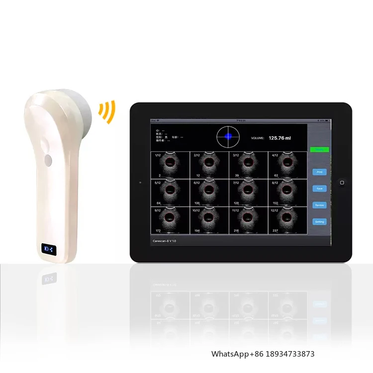 BProbe-2 4D handheld 80 element black and white array scan Wireless Bladder ultrasound Scanner probe