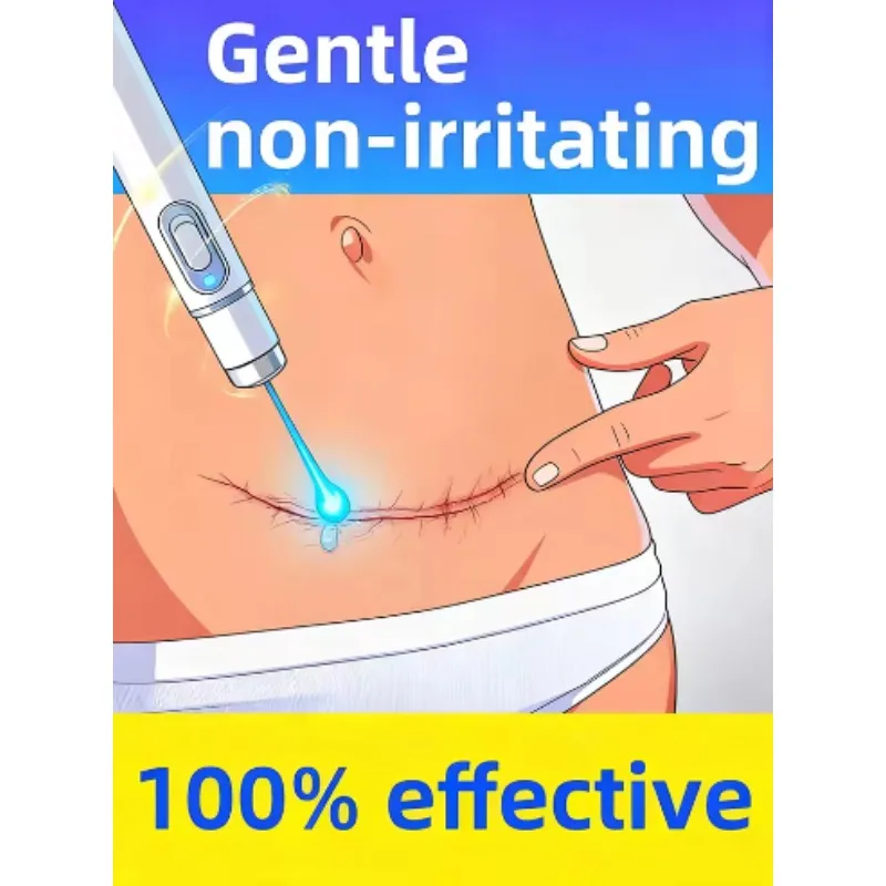 

Лазерные ручки второго поколения для решения проблем из шрамов и сохраняют здоровью кожи.