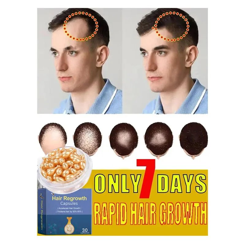 Hair Growth Serum 7 Days Fast Regrowth Essential Capsule Anti Hair Loss Baldness Repair Damaged Scalp Treatment For Women Men