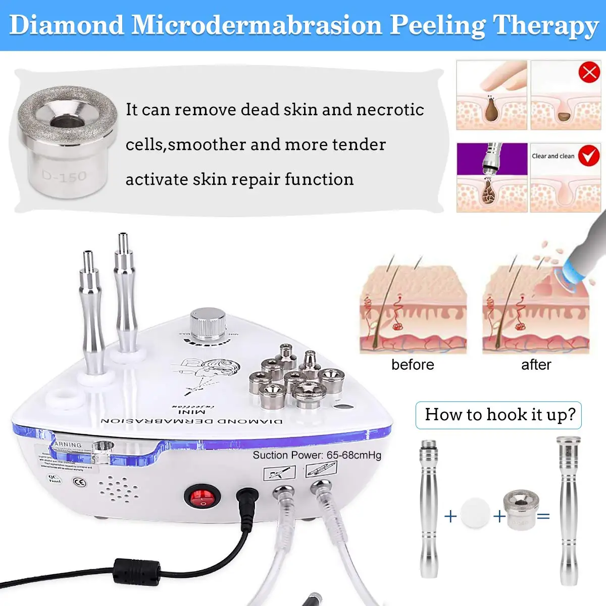 Professional Diamond Microdermabrasion Machine 65-68cmHg Suction Facial Exfoliation Skin Dermabrasion Machine Beauty Salon