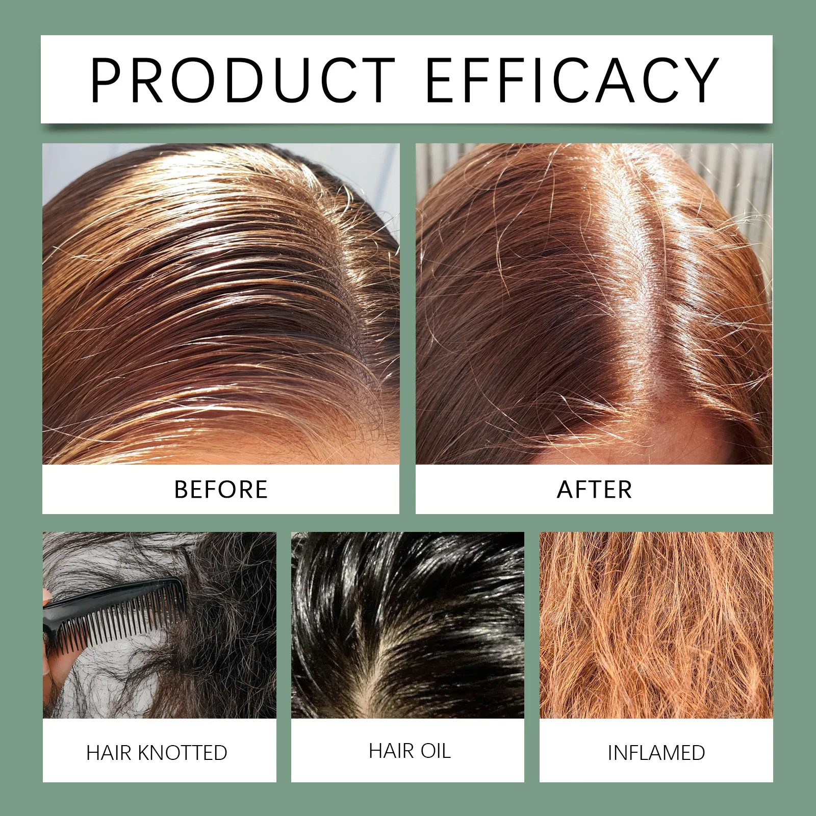 شامبو رغوي عضوي طبيعي لجميع أنواع الشعر، تنظيف لطيف، مكثف، مغذي، مضاد للتجعد، مرطب للعناية بالشعر #5