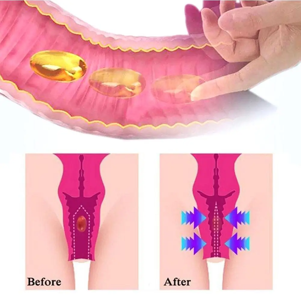 Anti-itch Detox Slimming Capsules Instant Itching Stopper Body Shaping Capsule Firming Repair Arms Belly Female Body Care