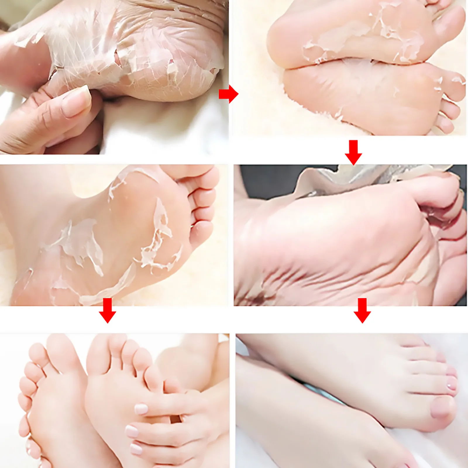 5/1Pairs Foot Peel Mask Skin Exfoliating Foot Masks for Dry Rough Cracked Feet Heels Callus, Dead Skin Remover Feet Peeling Mask