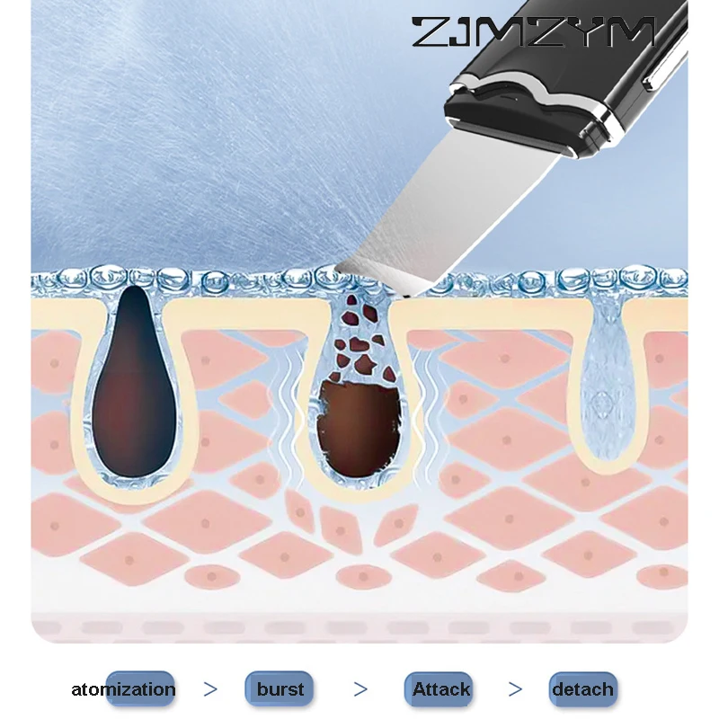 Espátula Facial con vibración ultrasónica, eliminador de espinillas, pala de acné, exfoliación limpia, Lifting Facial, cuidado de la piel