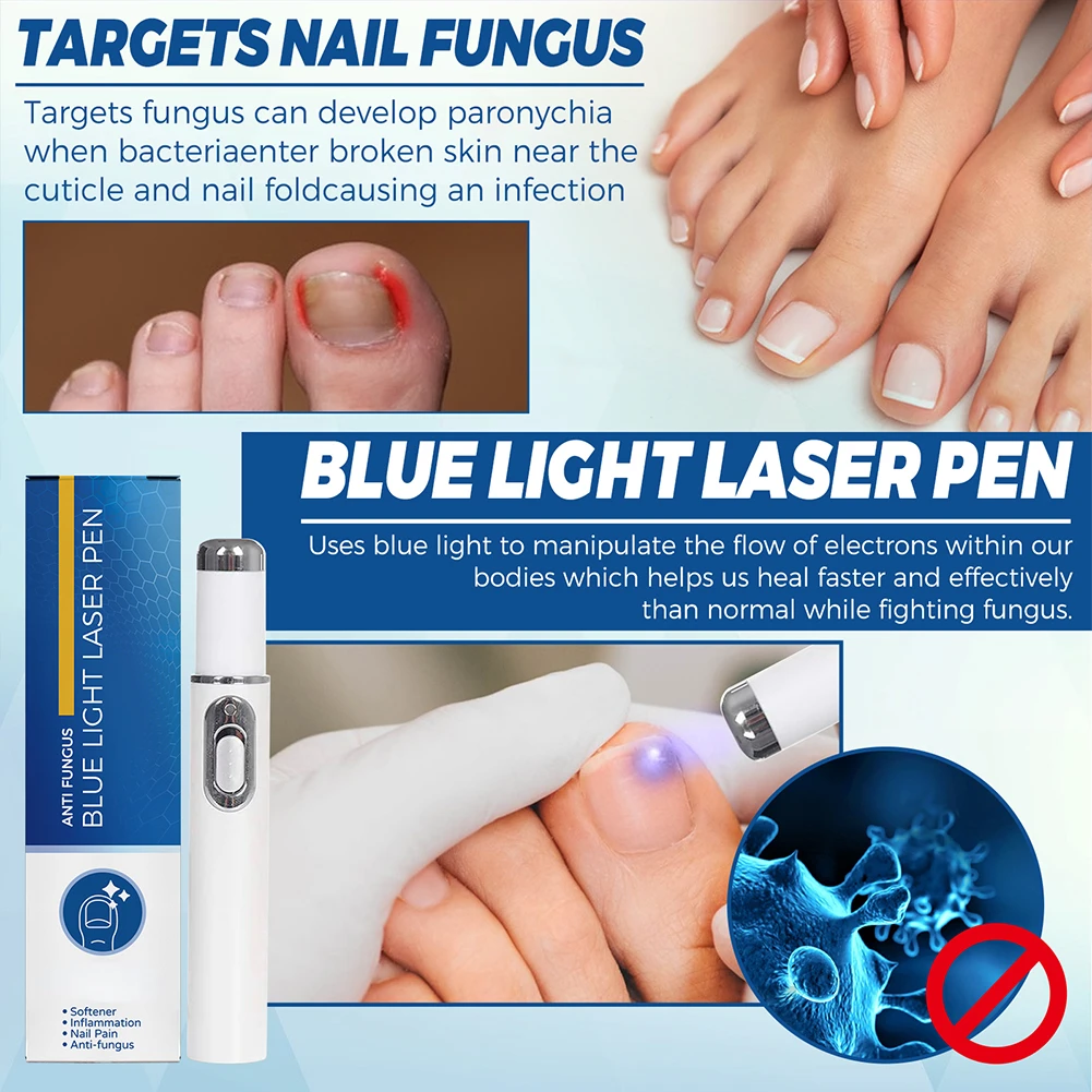 1ชิ้นปากกาการรักษาเชื้อราเล็บป้องกันเชื้อราซ่อมแซมปากกาสีฟ้า pulpen Laser paronychia เล็บ Onychomycosis กำจัดขนไม่เจ็บปวดดูแล