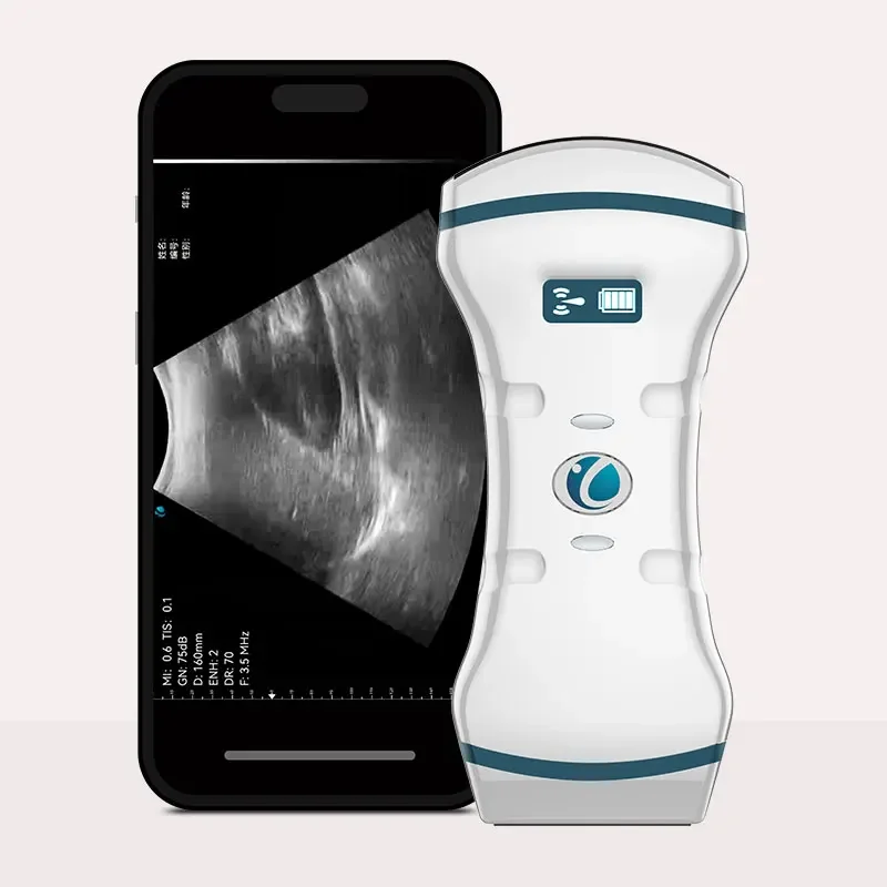 china bestdouble head pocket ultrasound 2 in 1 colorful wifi handheld ultrasound probe manufacturing for clinic hospital