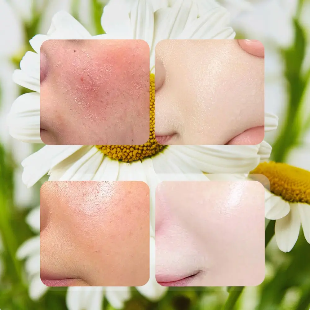 For Fykly Rose VC Chamomile B5 Vitamin Facial Mask Sheet Skincare Deep Hydration Moisturizing Soothing Beauty Treatment