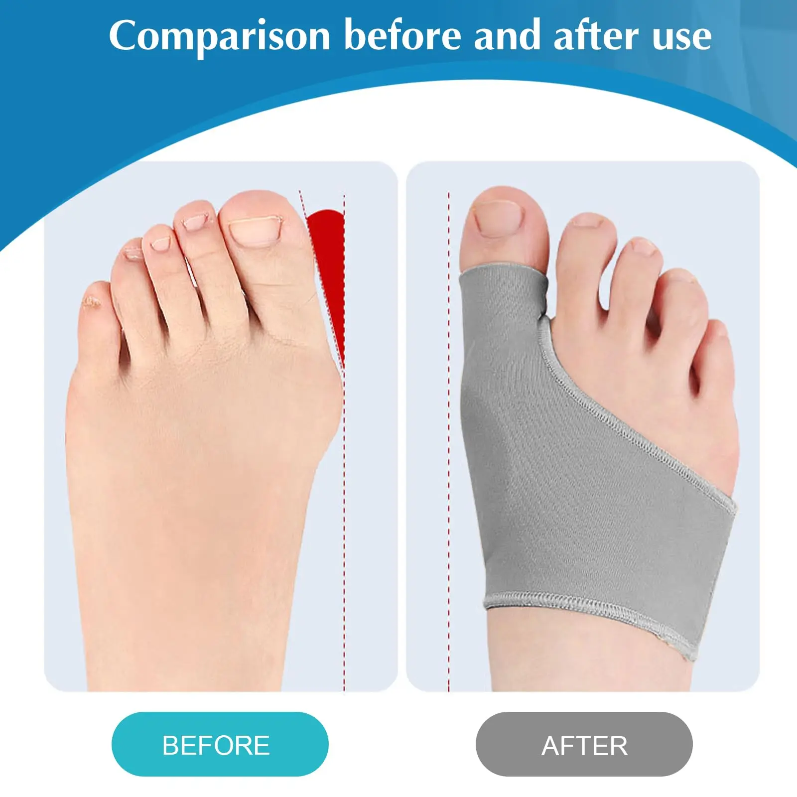 فاصل أصابع القدم أروح الورم مصحح تقويم العظام قدم العظام الإبهام الضابط تصحيح باديكير جورب مستقيم