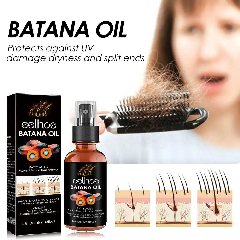 Batana Oil Hair Growing Spray Products Hair Loss Treatment Oil Fast Care for Men Women Beauty Health Care 30ml