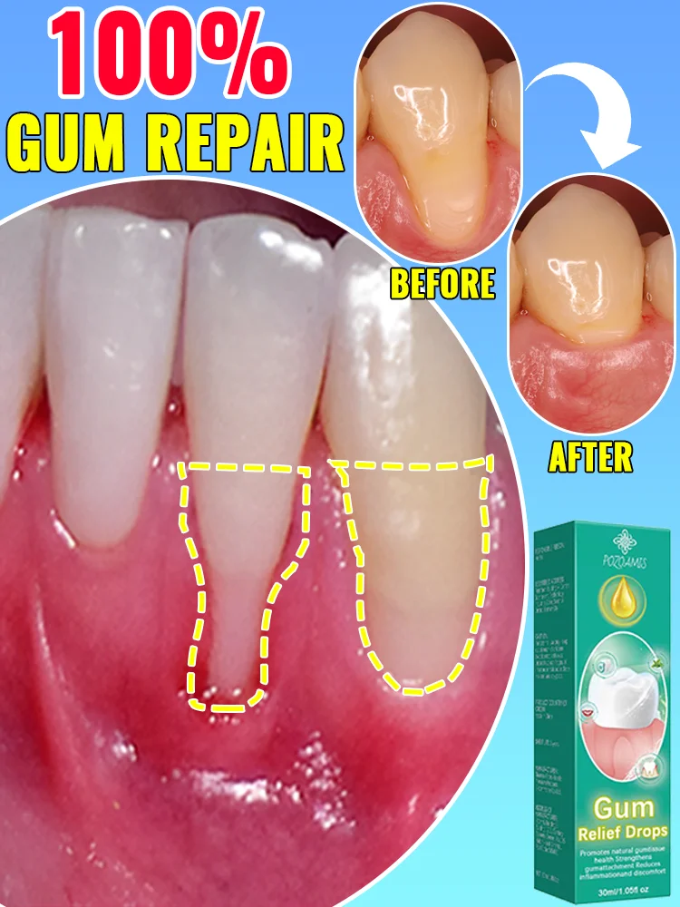 

Healthy gums in 7 days