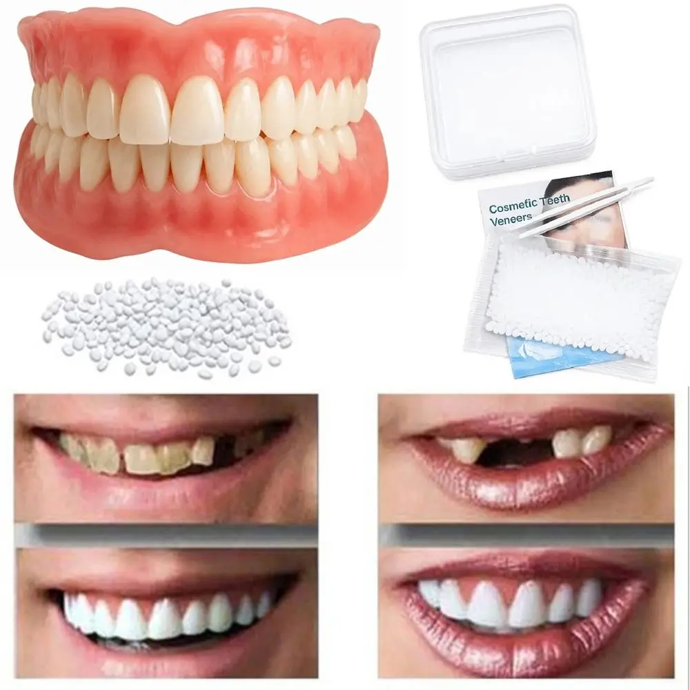 DIY Silicone False Teeth Confident Smile Whitening Temporary Fake Tooth Realistic with Filling Teeth Glue Cosmetic Dental Veneer