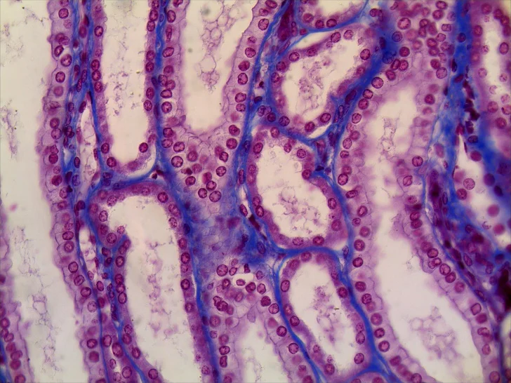 BestScope – caméra numérique pour Microscope trinoculaire HD BHC3E-1080P