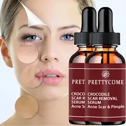 Retinol rosto soro hidratante reparação pele clarear anti-envelhecimento anti-rugas profunda cuidados com a pele essência acne cicatriz remoção