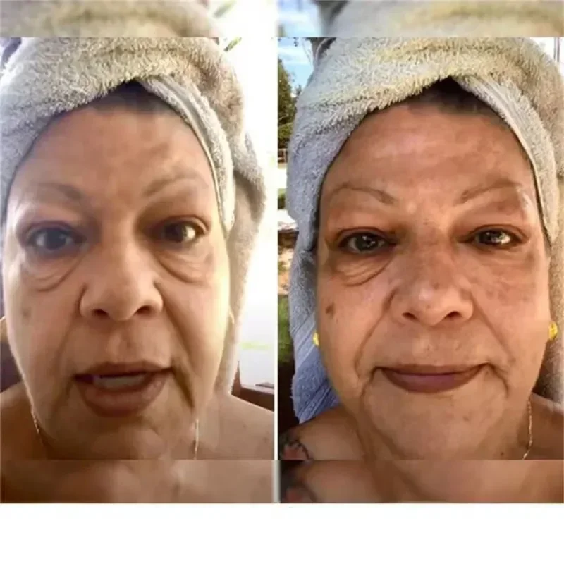 10 Instant Eye Bag Removal Cream Collagen Anti-Wrinkle Fade Fine Lines Firming Skin Anti Dark Circle Puffiness Brighten Eye Care