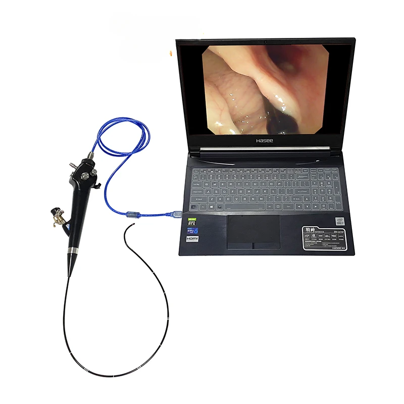 Veterinary Video Flexible Ureteroscopy Veterinary Equipment Flexible Ureteroscopy Veterinary Hospital