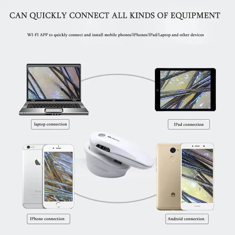 لاسلكي 200X بصيلات الشعر كاشف فروة الرأس محلل الجلد الرقمي كاشف بصيلات الشعر المجهر عالية الوضوح اختبار الجلد #4