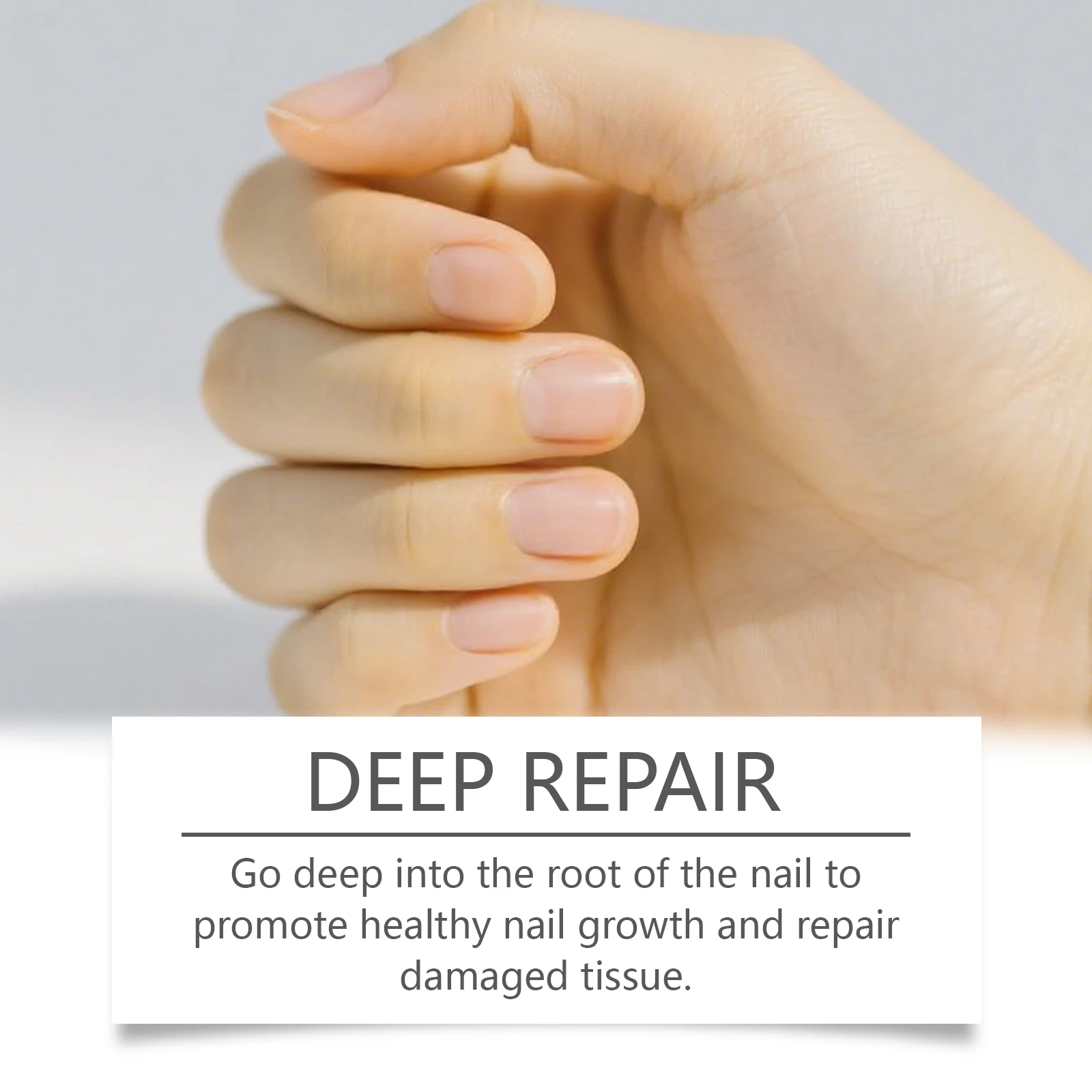 손발톱 무좀 치료 발톱 곰팡이 강력한 손발톱 무좀 치료제 손발톱 복구 성장 치료제 손발톱 연화제