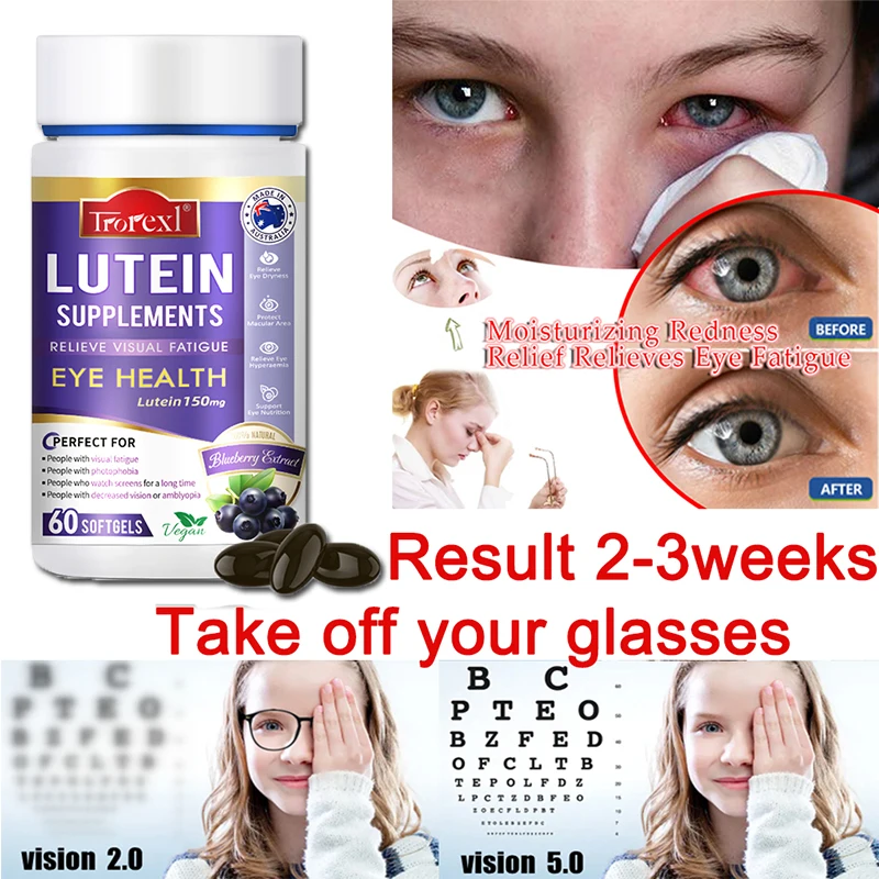 Trorexl Restore Vision Lutein Extract Supplement for Eye Strain Relieve Eye Fatigue Red & Dry Eye