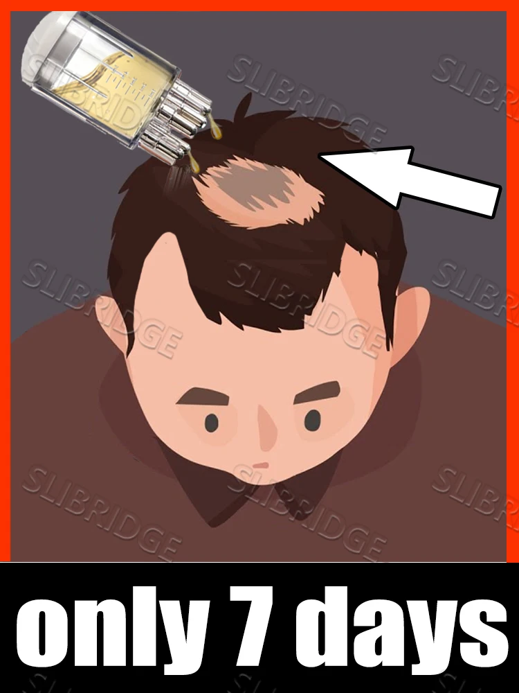 

UPGRADE Combo Scalp Applicator Liquid Comb Portable Mini Massage Comb Liquid Guiding Massager Anti Hair Loss Scalp Care Tool 7da