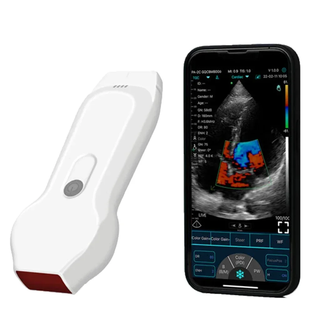 128E 2 in 1 Wireless Ultrasound Probe Color Doppler Cardiovascular Linear+Cardiac Ultrasound Scanner Support IOS Android Windows