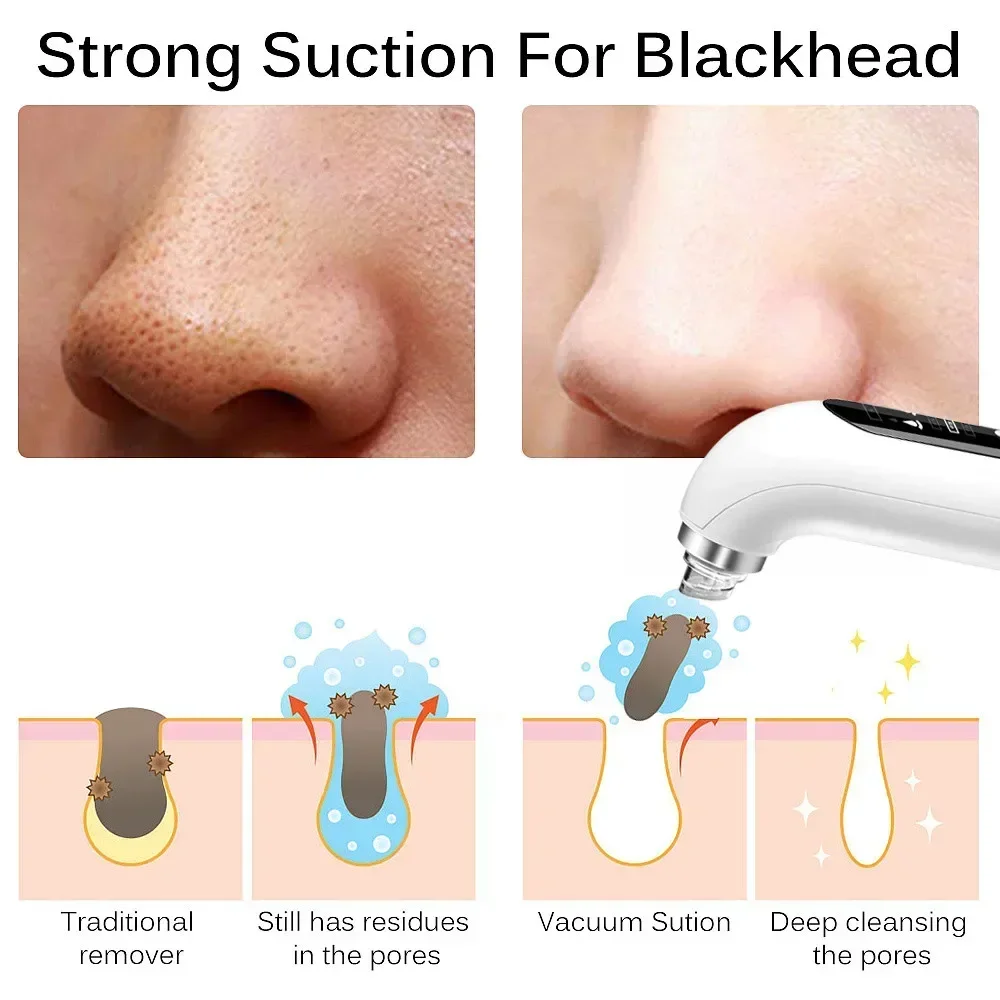 Blackhead Remover Pore Vacuum Face Cleaner Electric Pimple Black Head Removal USB Rechargeable Water Cycle Facial Cleaning Tools