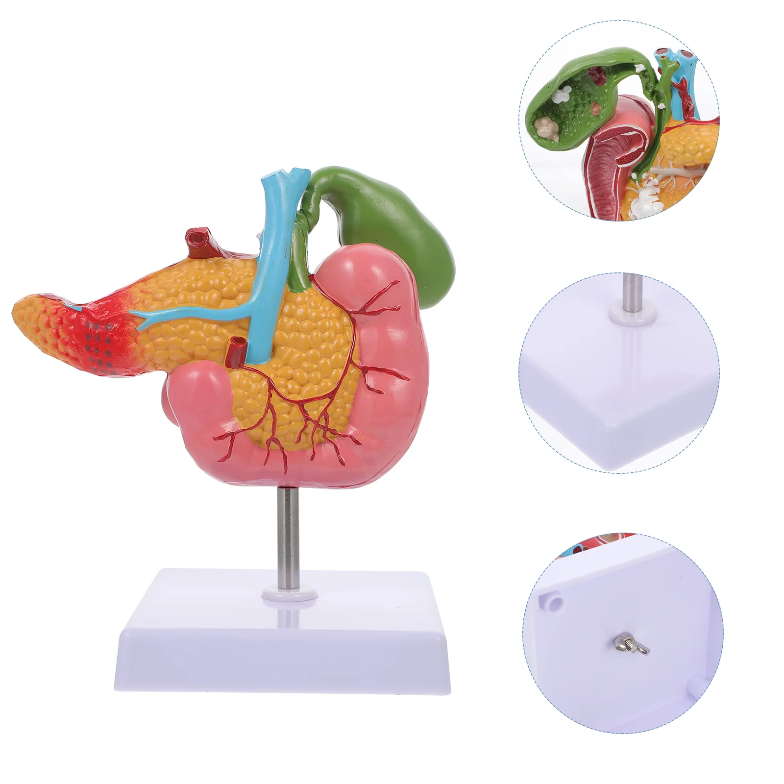 

Pathological Model of Gallbladder Human Pancreas Biology Teaching Duodenum Lesion Gallstone Digestive System