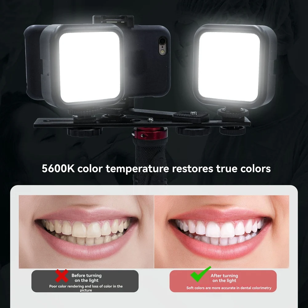 

NEW_Hera MK-004 Dental Phone Photography Light Professional Lighting