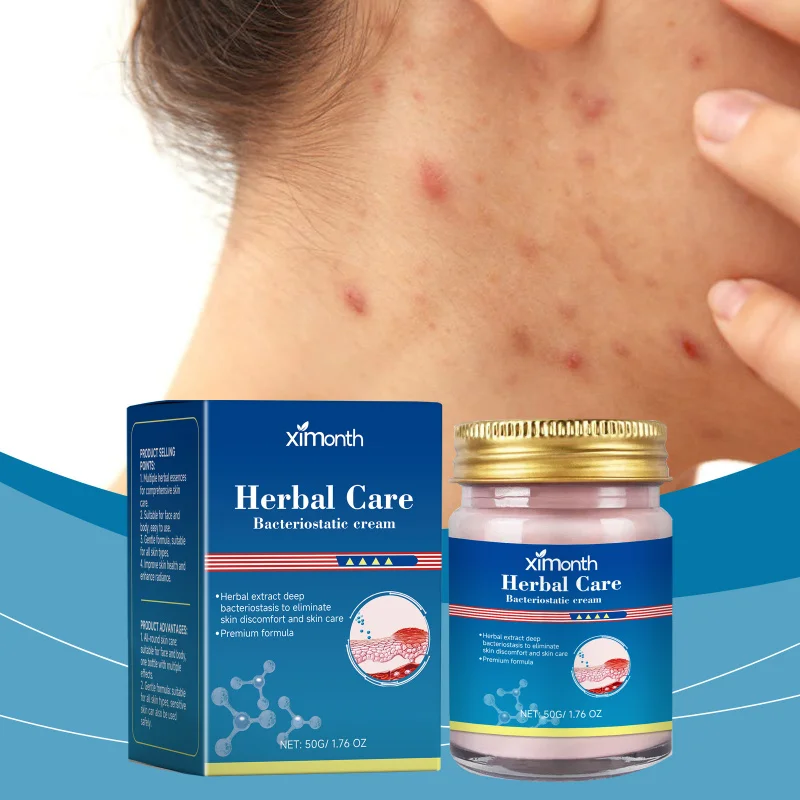 

Herbal Skin Care Repair Cream - Moisturize, Soothe, Reduce Redness, Relieve Discomfort, Face & Body, 50g