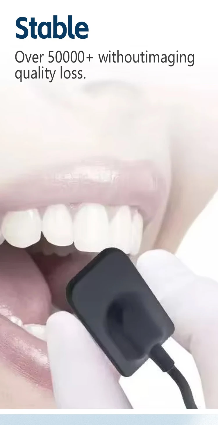 Professioneller Dental-Röntgensensor - Radiovisiograph-Bildgebungssystem - Hochfrequenz-Intraorale Filmarbeit & Kamera-Zahnmedizinische Ausrüstung – Detail 5
