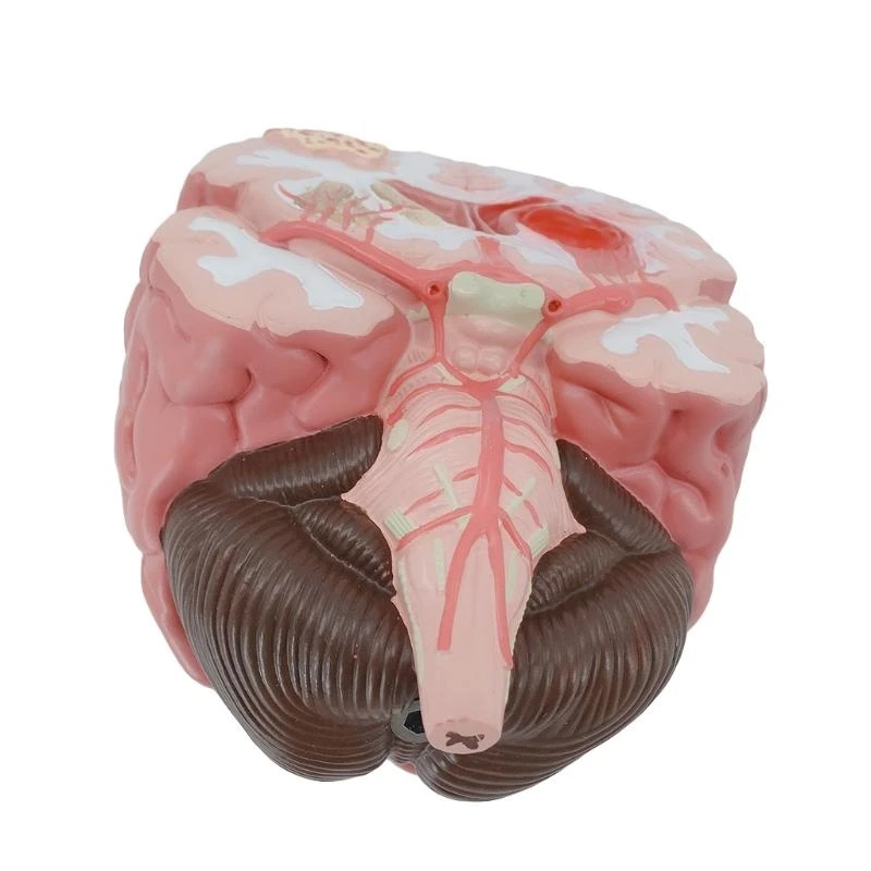 نموذج تشريحي للدماغ مع شرايين جذع الدماغ والقشرة الدماغية وما إلى ذلك من المحاضرات تستخدم أفضل المبيعات