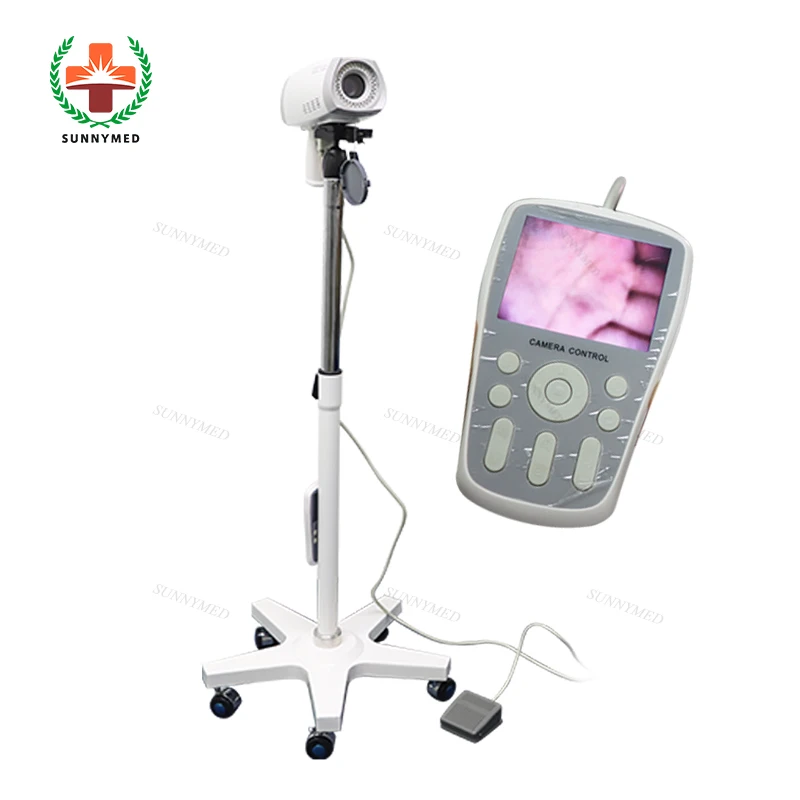 SUNNYMED SY-F005 Portable Digital Video vagina Colposcope Equipment