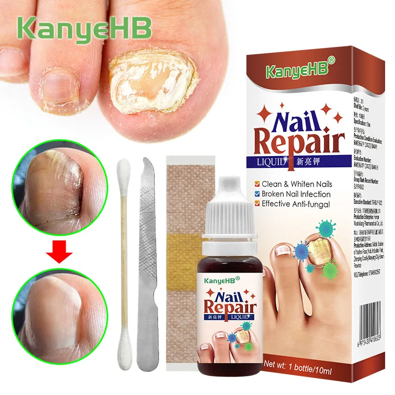 

KanyeHB Grey Finger and Toenal Liquid, Hand Nail and Toenal Liquid, Grey Nail Cleansing