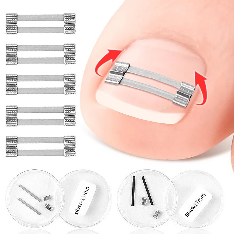 15/17mm Ingrown Toenail Corrector Clip Brace Tools Pedicure Recover Embed Toe Nail Treatment Professional Toenail Straightenings