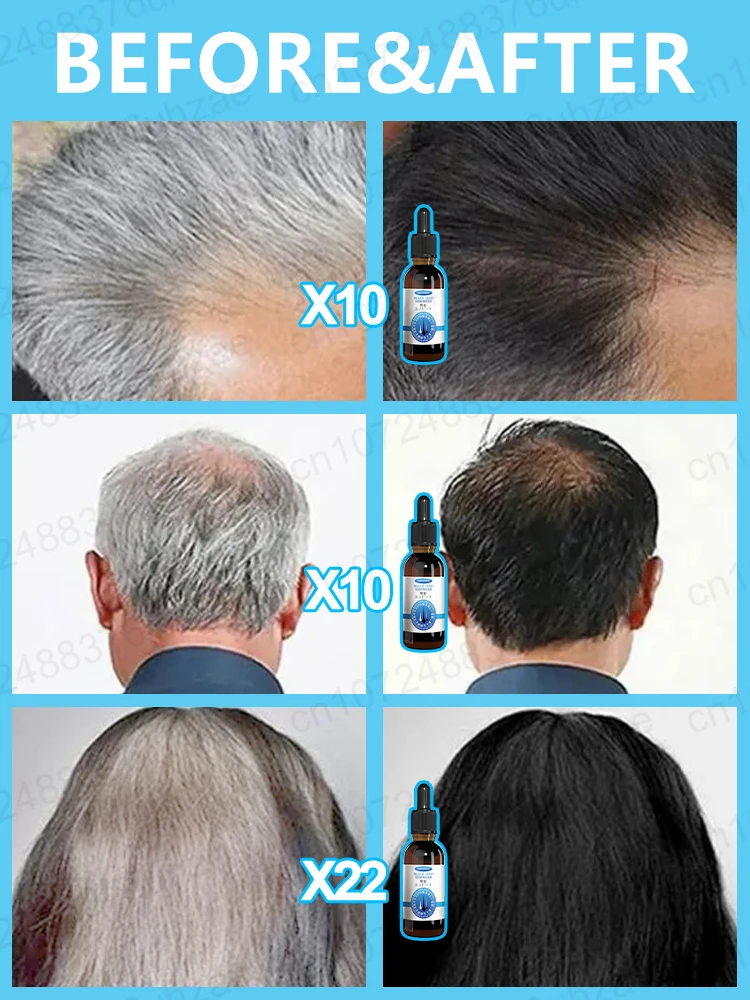 Suero para el tratamiento del cabello gris, blanco a negro, Color Natural, reparación, productos nutritivos, cuidado anticaída del cabello, hombres y mujeres