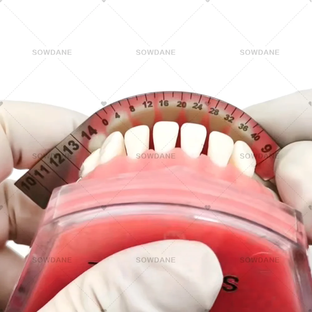 

S Stainless Steel lab Implants Space Assessment Gauge Orthodontics Lisa Gauge for Preparation of Prosthodontics Rehabilitations