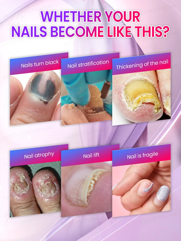 ᴿᵉᵐᵒᶜ̧ᵃ̃ᵒ ᵖʳᵒᶠⁱˢˢⁱᵒⁿᵃˡ ᵈᵒ ᶠᵘⁿᵍᵒ ᵈᵒ ᵖʳᵉᵍᵒ