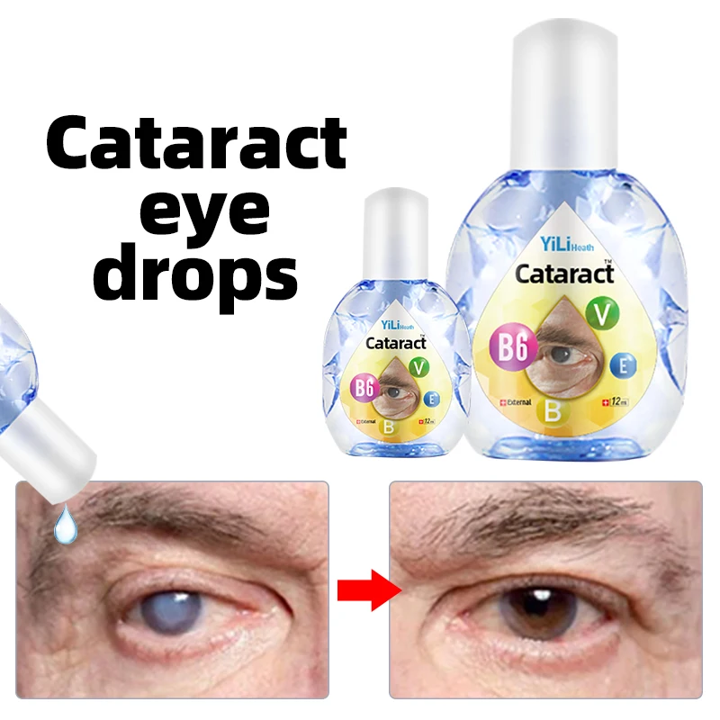 Cataract Treatment Eye Drops for Dry Eyes and Cloudy Eyeball Black Shadow Removal Vitamin B6 Blurred Vision Cure 12ml