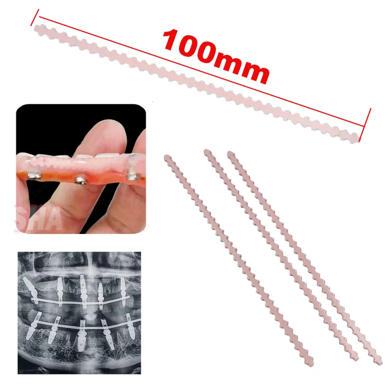 5/10 Pcs Dental Pink Strengthener Wires Implant Connector Titanium  Wire Bar Overdenture MU Wires 100mm Length
